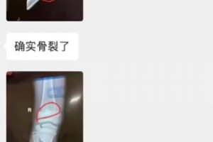 孙继海无辜！你这妈不是因为孩子受伤才退出，而是去当地的俱乐部